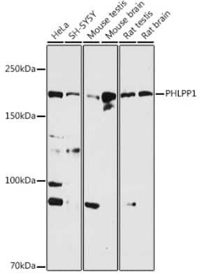 Western Blot: PHLPP Antibody [NBP2-93296] - Western blot analysis of extracts of various cell lines, using PHLPP antibody (NBP2-93296) at 1:1000 dilution. Secondary antibody: HRP Goat Anti-Rabbit IgG (H+L) at 1:10000 dilution. Lysates/proteins: 25ug per lane. Blocking buffer: 3% nonfat dry milk in TBST. Detection: ECL Basic Kit. Exposure time: 30s.